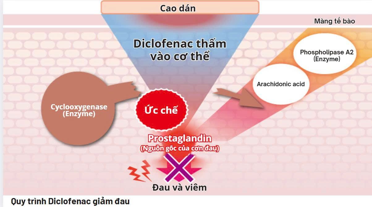 Image of alleviating pain by Diclofenac